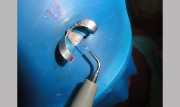 Dental clinic in Anand                        